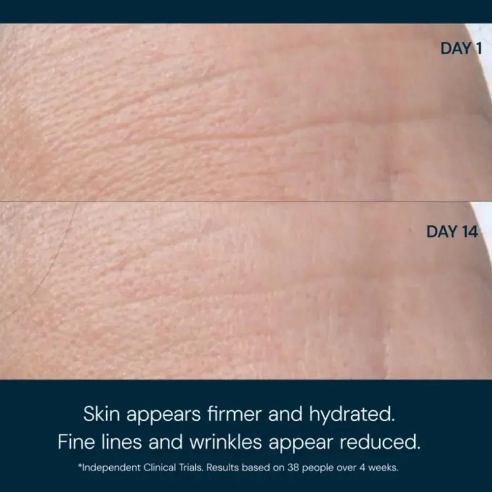 ELEMIS help support
